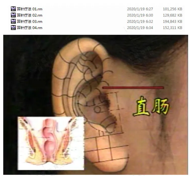 图片[2]-耳针疗法耳穴耳针穴位技术视频教程【百度网盘下载】